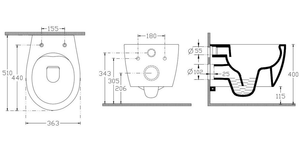 Подвесной унитаз Allen Brau Fantasy 4.11004 безободковый