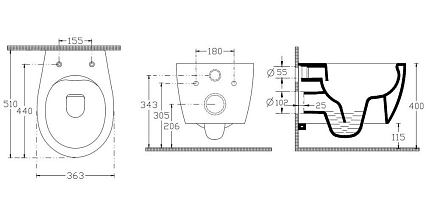 Подвесной унитаз Allen Brau Fantasy 4.11004 безободковый